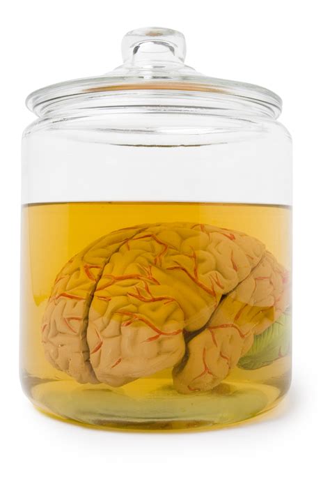 100 Human Brains Went Missing From The University Of Texas Time