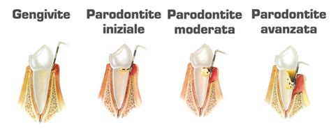 Parodontologia Augusta Siracusa