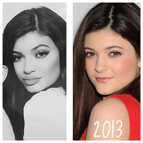 Kylie Jenner Plastic Surgery Before And After Images The Teal Mango