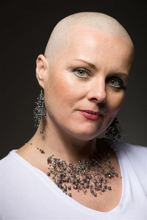 Beautiful Woman Cancer Patient Without Hair Stock Image Image Of Elegant Medical 104381311