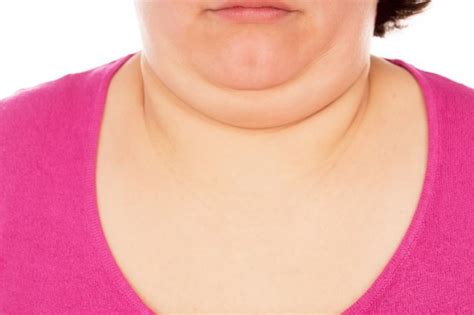 20 Tips How To Lose Neck Fat In A Short Time Charlies Magazines