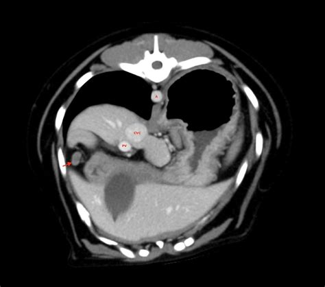 Pancreaticoduodenal Lymph Node A Aorta Cvc Caudal Vena Cava Pv