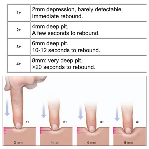 Pitting Edema Scale ⭐️ Anatomie Medisch Huid