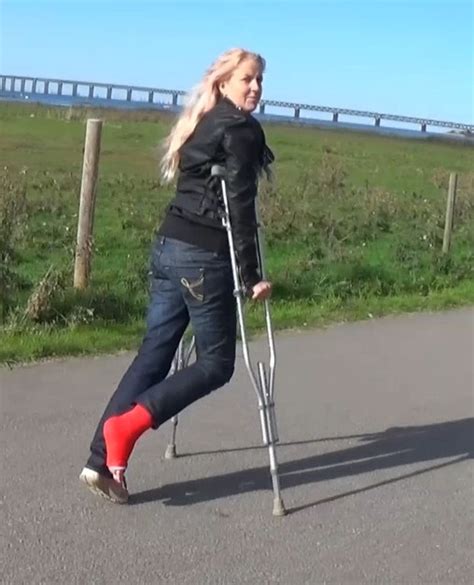 Crutchcast Clips Casts Braces Sprain Crutches Bandage Cnews