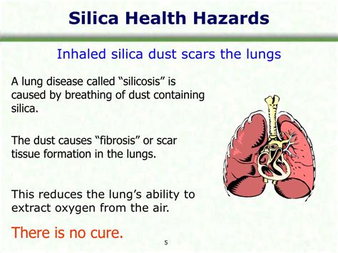 Ppt Silica Awareness Powerpoint Presentation Free Download Id1803396