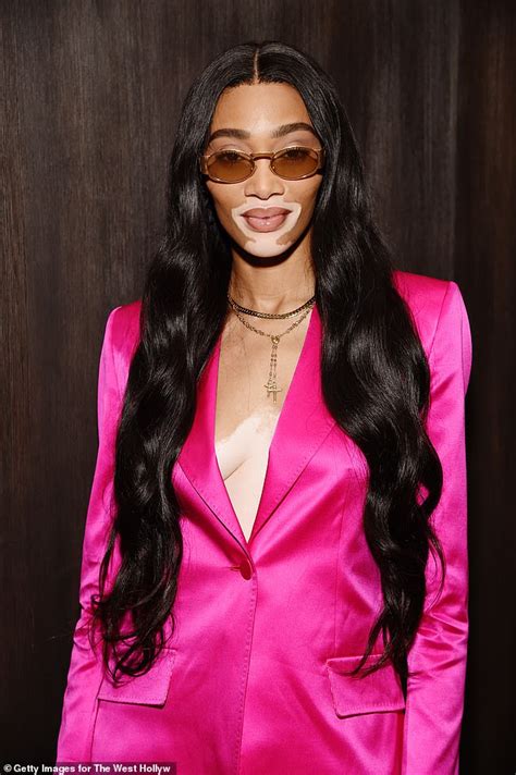 Winnie Harlow Teases A Glimpse Of Her Braless Assets In