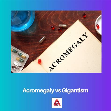 acromegaly vs gigantism difference and comparison