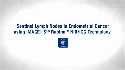 Sentinel Lymph Nodes In Endometrial Cancer Youtube