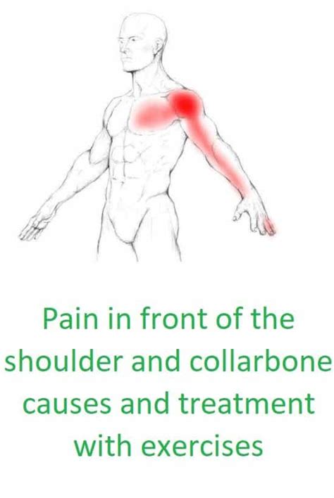Shoulder Pain Cause Symptoms And Treatment With 6 Exercises