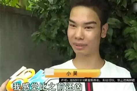 Xiao Wu Who Was Once Popular Because Of Her Hairline Now Has A Big