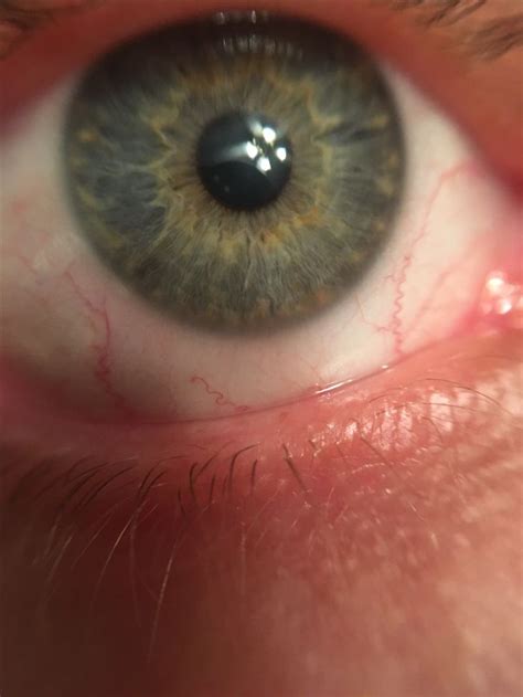 Pin On Eye Patterns