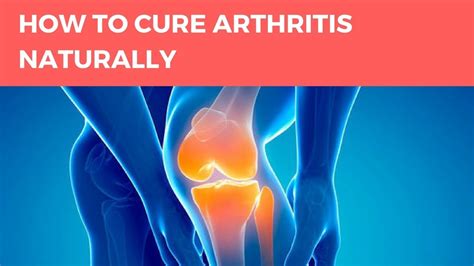 How To Cure Arthritis Naturally The Arthritis Step By Step Strategy