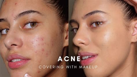 How To Cover Acne With Makeup Base Routine Youtube