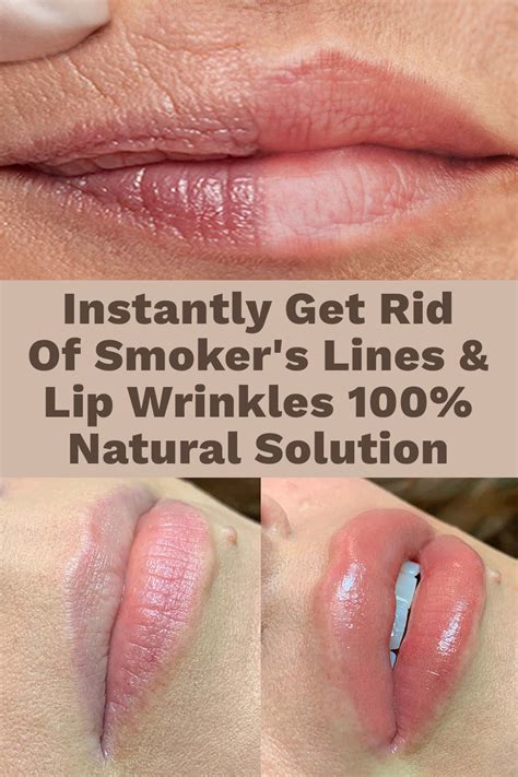 How To Maintain Healthy And Luminous Lips In 2023 Lip Wrinkles Natural
