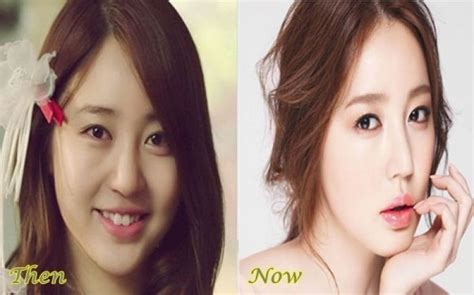 Korean Actresses Plastic Surgery Before Amp After Plastic Surgery The