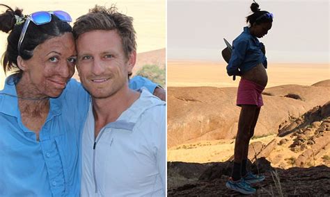 Turia Pitt Shows Off Her Baby Bump On Safari With Fianc Daily Mail Online
