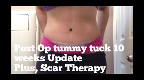 Post Op Tummy Tuck 10 Weeks Update Plus Scar Therapy Youtube