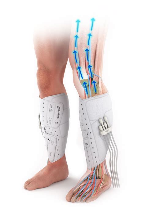 Phlebo Press® Dvt Mego Afek Ac Ltd Pneumatic Compression Therapy