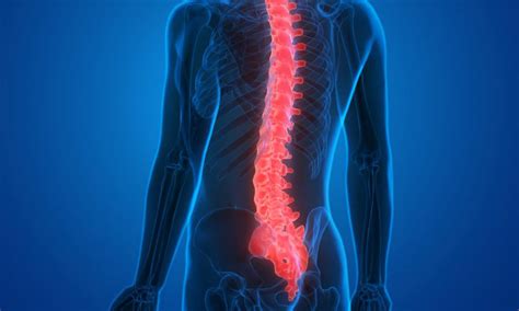 Spinal Cord Injury Attorney Burbank Bng Legal Group