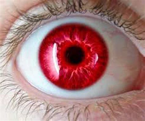 Ojos Rojos Marihuana Cómo Eliminar El Color Rojo De Los Ojos