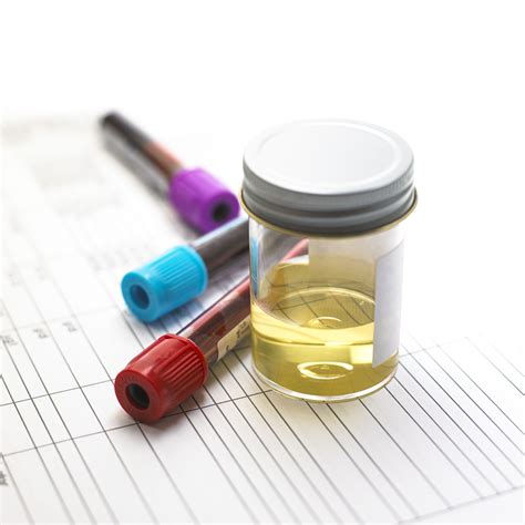 Urine Testing For Gonorrhea Chlamydia And Other Stds