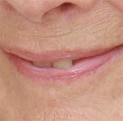 Lippen Quiz Welcher Mund Gehört Zu Welcher Dame Bilder And Fotos Welt