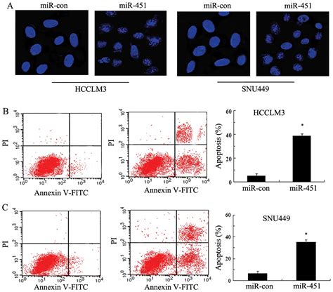 mir 451 potential role as tumor suppressor of human hepatoma cell growth and invasion