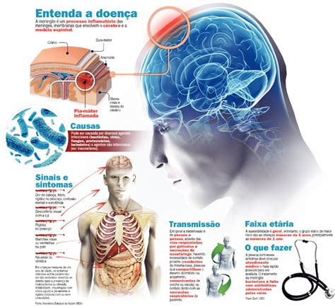 Tratamento Da Meningite Exige Atendimento Imediato Veja Os Sintomas Da