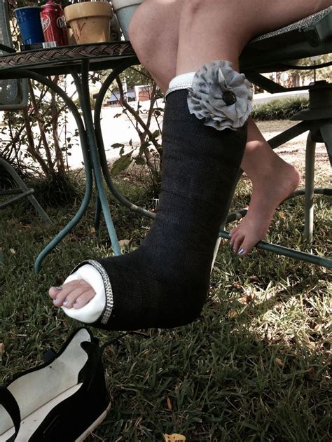 34 best fabulous leg casts images on pinterest leg cast broken foot and crutches