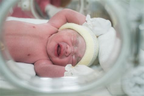Kondisi Yang Memerlukan Resusitasi Bayi Baru Lahir Alodokter