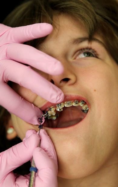 How To Pick An Orthodontist Health