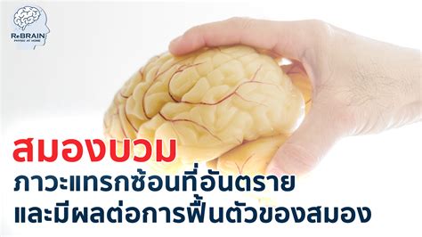 สมองบวม สมองบวม ภาวะแทรกซ้อนที่อันตราย และมีผลต่อการฟื้นตัวของสมองภา