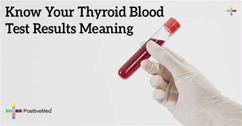 Know Your Thyroid Blood Test Results Meaning Positivemed