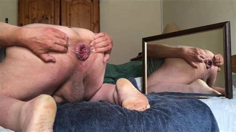 Compilation Anal Gapes With An Orange Free Gay Porn 39 Xhamster