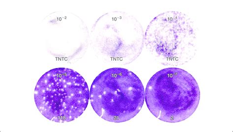 D31 Crystal Violetstained Plaque Assay Plate Bhk21 Cells Were