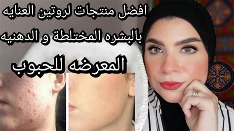 افضل روتين يومى للعنايه بالبشره المختلطه و الدهنيه المعرضه للحبوب