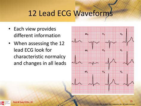 Ppt 12 Lead Ecgs And Electrical Axis Powerpoint Presentation Free