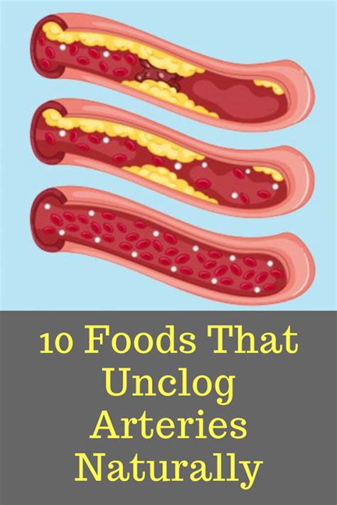 10 Foods That Unclog Arteries Naturally Natural Healing Remedies