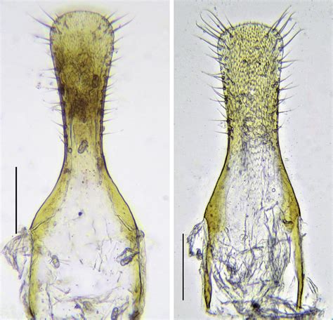 Sternite Ix A Anthrenus S Str Chikatunovi N Sp Holotype Male