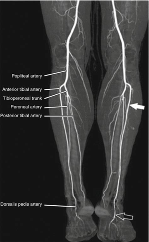 Ankle Vein Anatomy