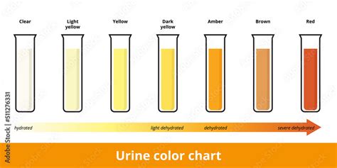 Urine Color Chart Pee Color Urinal Hydration Mrs Pip Urine Color The