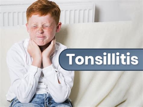 Tonsillitis Causes Types Symptoms Diagnosis And Treatment