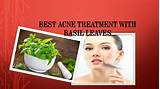 Photos of What''s The Best Acne Treatment