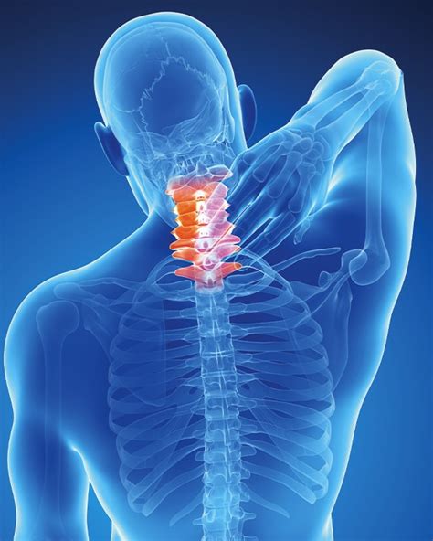 Neck Pain Chiropractor Hilton Head Fraum Center For Restorative Health