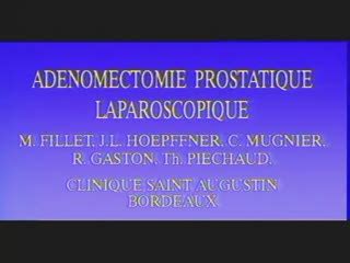 Ad Nomectomie Prostatique Laparoscopique Canal U