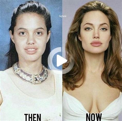 Pin On Beautiful Celebrities Beautiful Celebrities Angelina Jolie Plastic Surgery Plastic