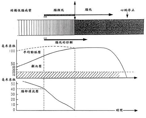 The site owner hides the web page description. joinjoin彭醫師 - 各種病因導致腦死之路徑模式圖IICP與腦死的關係 - Plurk