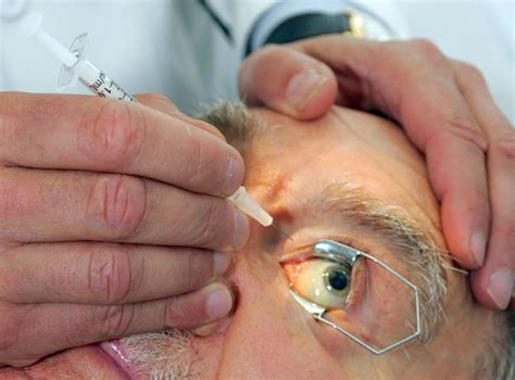 New Treatment For Age Related Macular Degeneration Newswise News For