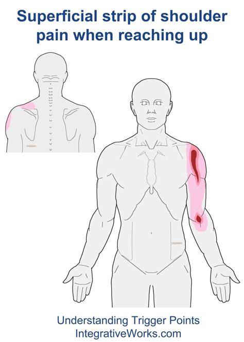 Pain In Front Of Shoulder Reaching Forward Integrative Works