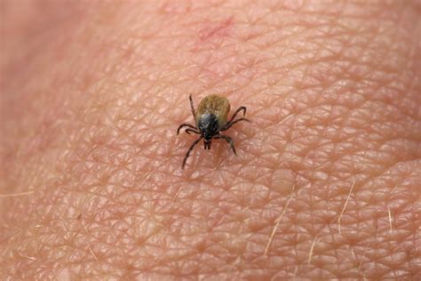 Expert Warns Of New Tick Borne Disease